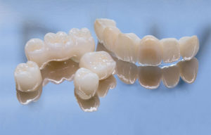 宇治市 歯医者 zirconia なかむら歯科医院
