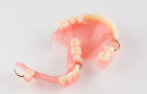 宇治市　歯医者　partial denture　なかむら歯科医院