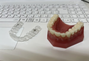 宇治市　歯医者　mouth piece　なかむら歯科医院