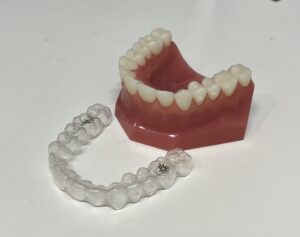 宇治市　歯医者　invisalign fast　なかむら歯科医院