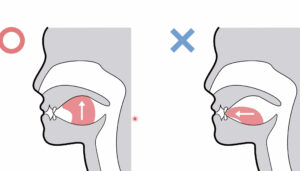 宇治市　歯医者　nose breath　なかむら歯科医院