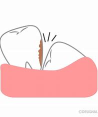 宇治市　歯医者　8caries　なかむら歯科医院