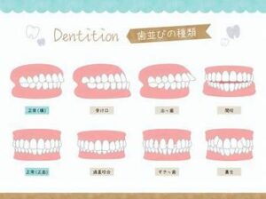 宇治市　歯医者　malocclusion　なかむら歯科医院