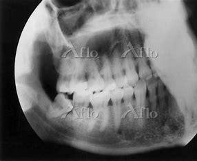 宇治市　歯医者　3molar　なかむら歯科医院