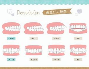 宇治市　歯医者　row of teeth　なかむら歯科医院