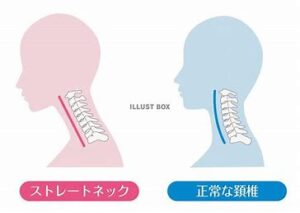 宇治市　歯医者　cervical vertebrae　なかむら歯科医院　