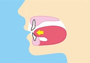 宇治市　歯医者　low tongue　なかむら歯科医院