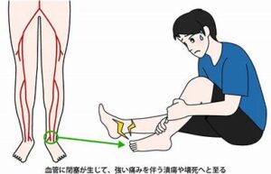 宇治市　歯医者　buerger disease　なかむら歯科医院