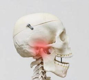 宇治市 歯医者 tmd なかむら歯科医院