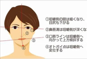 宇治市　歯医者　face distortion　なかむら歯科医院