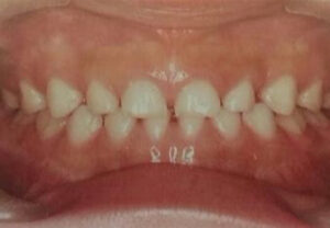 宇治市 歯医者 gap tooth なかむら歯科医院