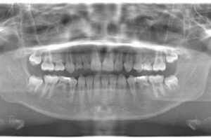宇治市　歯医者　panorama　なかむら歯科医院