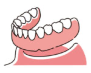 宇治市　歯医者　full denture　なかむら歯科医院