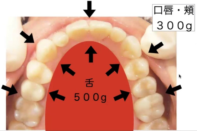 飲み込みが悪くなる・発音がうまくできない