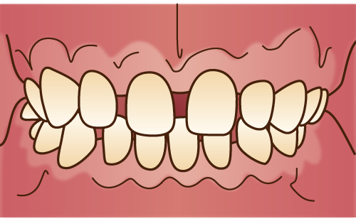 子供の歯並びを見た時に、隙間はありますか？