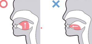 宇治市　歯医者　mouth breath　なかむら歯科医院