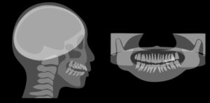 宇治市　歯医者　xray　なかむら歯科医院