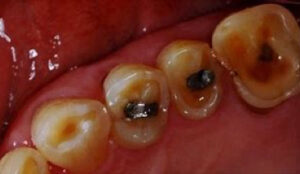 宇治市 歯医者 cruck なかむら歯科医院