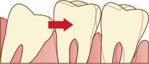 宇治市 歯医者 wisdom なかむら歯科医院