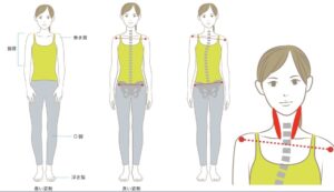宇治市　歯医者　body distortion なかむら歯科医院