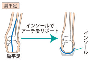 宇治市　歯医者　flat feet　なかむら歯科医院