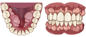 宇治市　歯医者　torus　なかむら歯科医院