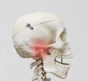 宇治市　歯医者　tmd　なかむら歯科医院