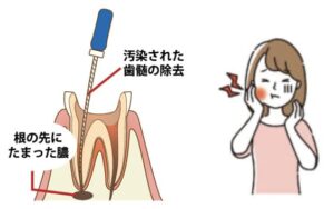 宇治市　歯医者　endo　なかむら歯科医院