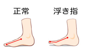 宇治市　歯医者　floating foot　なかむら歯科医院