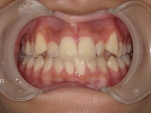 宇治市　歯医者　6462_ry_Oral front_20230725　なかむら歯科医院