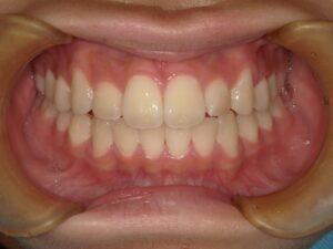 宇治市　歯医者　6462_ry_Oral front_20241120　なかむら歯科医院