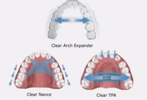 宇治市 歯医者 nance なかむら歯科医院