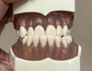 宇治市　歯医者　class 3　なかむら歯科医院