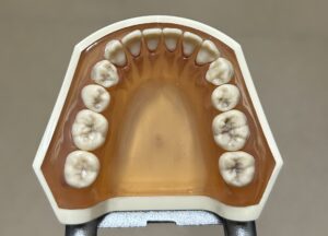 宇治市　歯医者　lower　なかむら歯科医院