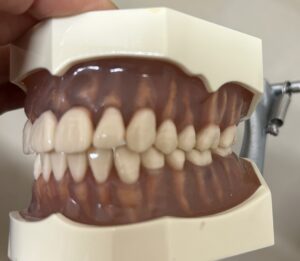 宇治市　歯医者　normal bite　なかむら歯科医院