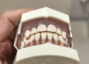 宇治市　歯医者　normal bite front　なかむら歯科医院