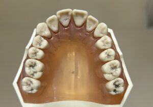 宇治市　歯医者　upper　なかむら歯科医院