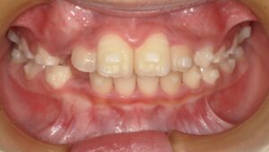 宇治市　歯医者　6843_mn_Oral front_20240909　なかむら歯科医院
