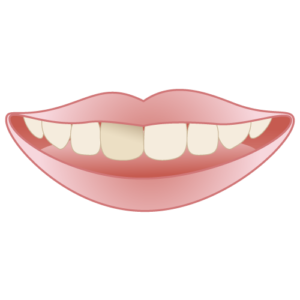 宇治市　歯医者　non vital tooth　なかむら歯科医院