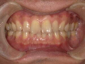 宇治市　歯医者　0126_yy_Oral front_20240119　なかむら歯科医院