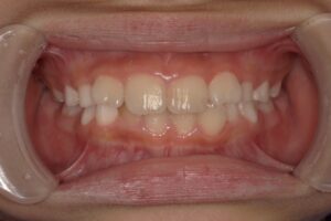 宇治市　歯医者　6854_hm_Oral front_20240413　なかむら歯科医院