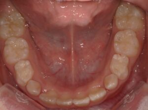 宇治市　歯医者　6854_hm_Oral lower_20241221　なかむら歯科医院