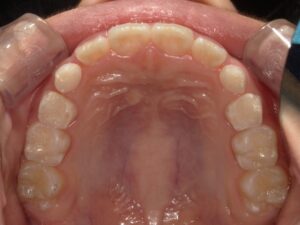 宇治市　歯医者　6854_hm_Oral upper_20241221　なかむら歯科医院