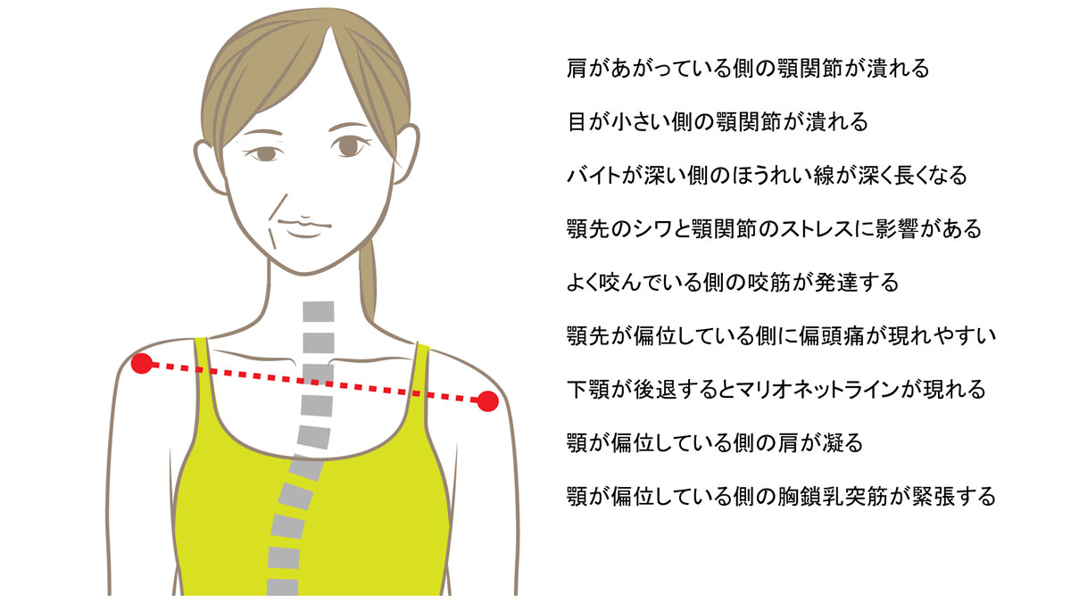 なかむら歯科医院　身体の歪みと歯科治療