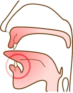 宇治市 歯医者 tongue なかむら歯科医院