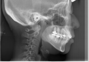 宇治市 歯医者 0007_kt_Cephalo LA_20241206 なかむら歯科医院