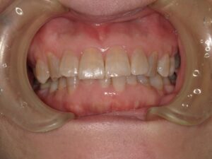 宇治市 歯医者0007_kt_Oral front_20230509 なかむら歯科医院