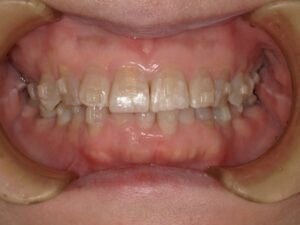 宇治市 歯医者 0007_kt_Oral front_20231205 なかむら歯科医院