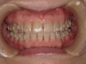 宇治市 歯医者 0007_kt_Oral front_20240524