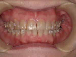 宇治市 歯医者 0007_kt_Oral front_20241101 なかむら歯科医院